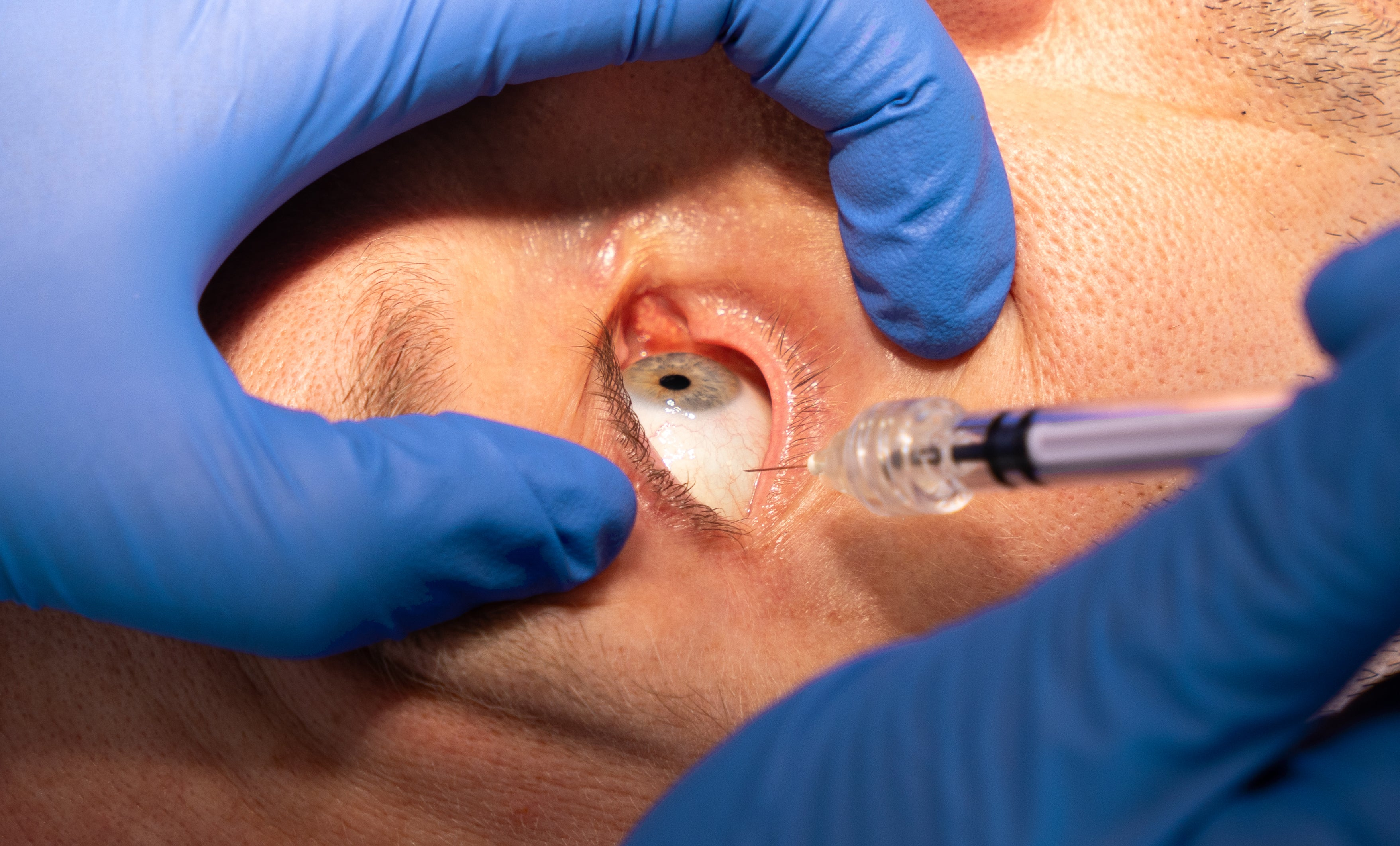 Ophthalmology